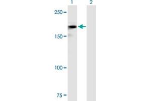 Western Blotting (WB) image for anti-Roundabout, Axon Guidance Receptor, Homolog 2 (ROBO2) (AA 1-1378) antibody (ABIN519830)
