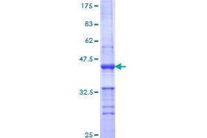 PLD1 Protein (AA 965-1074) (GST tag)