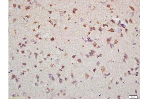 Formalin-fixed and paraffin embedded mouse brain labeled with Anti-NET1 Polyclonal Antibody, Unconjugated (ABIN1714215) at 1:200 followed by conjugation to the secondary antibody and DAB staining (NET1 Antikörper)