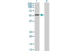Western Blot analysis of PFTK1 expression in transfected 293T cell line by PFTK1 MaxPab polyclonal antibody.