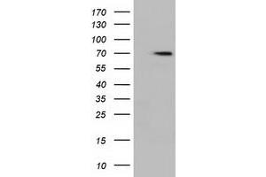 Western Blotting (WB) image for anti-Histone Deacetylase 10 (HDAC10) antibody (ABIN1498608)