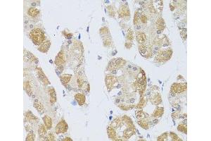 Immunohistochemistry of paraffin-embedded Human stomach using HDAC4 Polyclonal Antibody at dilution of 1:100 (40x lens). (HDAC4 Antikörper)
