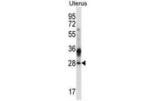 CIB4 Antibody (N-term) western blot analysis in human normal Uterus cell line lysates (35µg/lane). (CIB4 Antikörper  (N-Term))