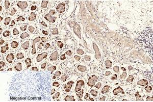Immunohistochemical analysis of paraffin-embedded human stomach tissue. (NF-kB p65 Antikörper  (acLys310))