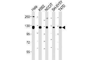 All lanes : Anti-ROR2 Antibody (C-term) at 1:1000-1:2000 dilution Lane 1: Hela whole cell lysate Lane 2: K562 whole cell lysate Lane 3: NCCIT whole cell lysate Lane 4: SH-SY5Y whole cell lysate Lane 5: T47D whole cell lysate Lysates/proteins at 20 μg per lane. (ROR2 Antikörper  (C-Term))