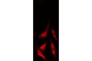 ABIN6277509 staining  LOVO cells by IF/ICC. (Cullin 2 Antikörper  (C-Term))
