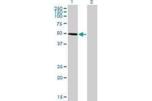 Western Blot analysis of ZNF277 expression in transfected 293T cell line by ZNF277 monoclonal antibody (M01), clone 1B2. (ZNF277 Antikörper  (AA 1-278))