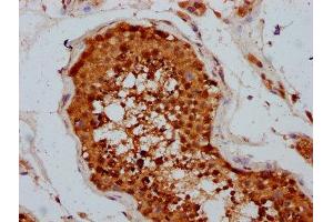 IHC image of ABIN7173536 diluted at 1:400 and staining in paraffin-embedded human testis tissue performed on a Leica BondTM system. (TSEN15 Antikörper  (AA 1-171))