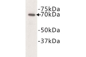 Western Blotting (WB) image for anti-Complement C3 beta Chain (C3b) antibody (ABIN1854871) (Complement C3b Antikörper)