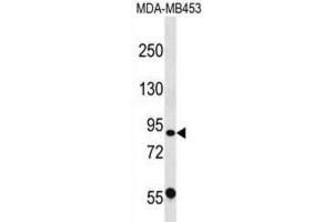 Western Blotting (WB) image for anti-Calpain 13 (CAPN13) antibody (ABIN2998758) (CAPN13 Antikörper)