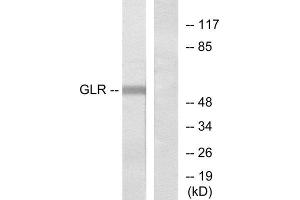 Western Blotting (WB) image for anti-Glycine Receptor, alpha 2 (GLRa2) (Internal Region) antibody (ABIN1852966) (GLRa2 Antikörper  (Internal Region))