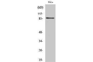 Western Blotting (WB) image for anti-UTP14, U3 Small Nucleolar Ribonucleoprotein, Homolog A (UTP14A) (Internal Region) antibody (ABIN3187442) (UTP14A Antikörper  (Internal Region))