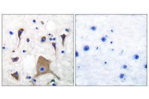 Immunohistochemistry (IHC) image for anti-Glutamate Receptor, Ionotropic, Kainate 1 (GRIK1) (N-Term) antibody (ABIN1848575)