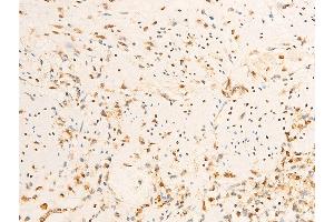 Immunohistochemistry (IHC) image for anti-Janus Kinase 1 (JAK1) (pTyr1022), (pTyr1023) antibody (ABIN6255762)