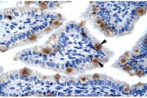 Immunohistochemical staining (Formalin-fixed paraffin-embedded sections) of human lung with MCM6 polyclonal antibody . (MCM6 Antikörper  (AA 771-820))