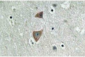 Immunohistochemistry (IHC) analyzes of p70 S6 kinase alpha antibody in paraffin-embedded human brain tissue. (RPS6KB1 Antikörper)