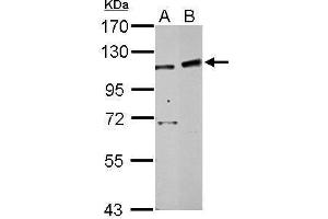 WB Image Sample (30 ug of whole cell lysate) A: 293T B: HepG2 7. (PHF16 Antikörper  (C-Term))