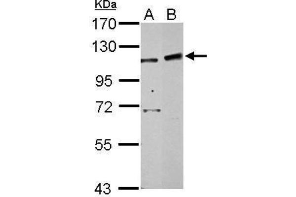 PHF16 Antikörper  (C-Term)
