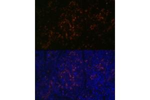Immunofluorescence analysis of mouse spleen using BTK Rabbit mAb (ABIN7265950) at dilution of 1:100 (40x lens). (BTK Antikörper)