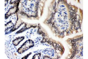 Anti- MSH2 Picoband antibody, IHC(P) IHC(P): Mouse Intestine Tissue (MSH2 Antikörper  (AA 337-583))