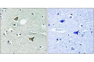 Immunohistochemistry (IHC) image for anti-Coiled-Coil Domain Containing 88A (CCDC88A) (AA 1383-1432) antibody (ABIN2889149) (Girdin Antikörper  (AA 1383-1432))