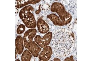 Immunohistochemical staining of human kidney with APIP polyclonal antibody  shows cytoplasmic and nuclear positivity in tubular cells. (APIP Antikörper)