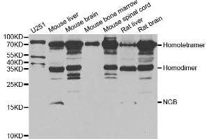 Western blot analysis of extracts of various cell lines, using NGB antibody. (Neuroglobin Antikörper)