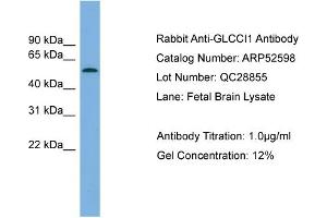 WB Suggested Anti-GLCCI1  Antibody Titration: 0.