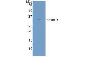 Detection of Recombinant LRP6, Human using Polyclonal Antibody to Low Density Lipoprotein Receptor Related Protein 6 (LRP6) (LRP6 Antikörper  (AA 981-1213))