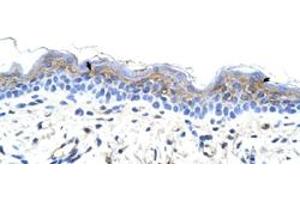 Immunohistochemical staining (Formalin-fixed paraffin-embedded sections) of human skin with IRX3 polyclonal antibody  at 4-8 ug/mL working concentration. (IRX3 Antikörper  (C-Term))