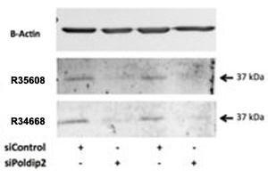 Western blot testing of rat VSMC lysate with POLDIP2 antibody at 0. (POLDIP2 Antikörper)