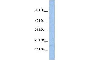 WB Suggested Anti-TRAPPC2 Antibody Titration:  0. (TRAPPC2 Antikörper  (Middle Region))