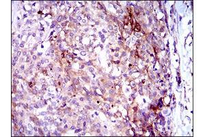 Immunohistochemistry (IHC) image for anti-Osteoactivin (GPNMB) (AA 31-260) antibody (ABIN1724859)