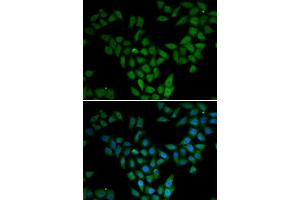 Immunofluorescence analysis of HeLa cell using ASF1A antibody.