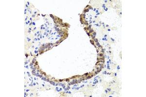 Immunohistochemistry of paraffin-embedded rat lung using TOPBP1 antibody (ABIN6134114, ABIN6149397, ABIN6149400 and ABIN6216254) at dilution of 1:100 (40x lens). (TOPBP1 Antikörper  (AA 1-100))