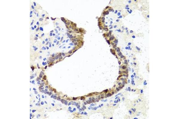 TOPBP1 Antikörper  (AA 1-100)