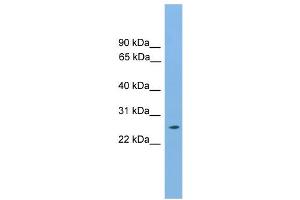 WB Suggested Anti-Hoxb9 Antibody Titration:  0.