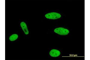 Immunofluorescence of monoclonal antibody to MLLT1 on HeLa cell. (MLLT1 Antikörper  (AA 472-559))