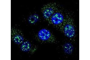 Confocal immunofluorescent analysis of MGMT antibody with MCF-7 cells followed by Alexa Fluor 488-conjugated goat anti-rabbit lgG (green). (MGMT Antikörper  (AA 1-30))
