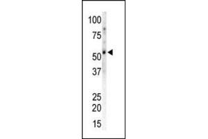 Western blot of CAMK2G / CAMKG Antibody to detect CAMK2 gamma in Mouse heart tissue lysate. (CAMKII gamma Antikörper  (C-Term))