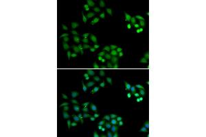 Immunofluorescence analysis of HeLa cells using NSFL1C antibody (ABIN6131003, ABIN6144873, ABIN6144874 and ABIN6222382).