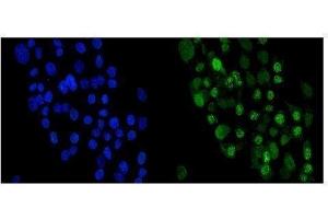 IF analysis of Periplakin using anti-Periplakin antibody (ABIN5518787). (PPL Antikörper  (C-Term))
