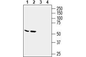 Western blot analysis of human MCF-7 breast adenocarcinoma cell line (lanes 1 and 3) and human LNCaP prostate adenocarcinoma cell line (lanes 2 and 4) lysates: - 1,2. (Slc6a14 Antikörper  (2nd Extracellular Loop))