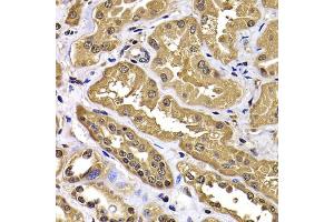 Immunohistochemistry of paraffin-embedded human kidney using WBSCR22 antibody (ABIN4905616) at dilution of 1:100 (40x lens). (WBSCR22 Antikörper)