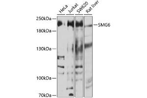 Western blot analysis of extracts of various cell lines, using SMG6 antibody (ABIN6133311, ABIN6148132, ABIN6148133 and ABIN6214288) at 1:1000 dilution. (SMG6 Antikörper  (AA 1160-1419))