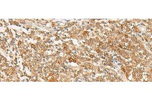 Immunohistochemistry of paraffin-embedded Human tonsil tissue using JPT1 Polyclonal Antibody at dilution of 1:35(x200) (JPT1 Antikörper)