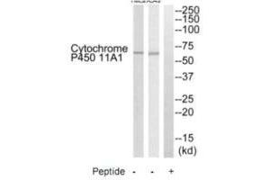 Western blot analysis of extracts from HeLa cells and A549 cells, using Cytochrome P450 11A1 antibody. (CYP11A1 Antikörper  (C-Term))