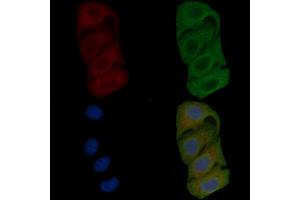 ABIN6257851 and ABIN6275627 staining Hela cells(45 min of heat-shock) by IF/ICC. (TSSK4 Antikörper  (Internal Region))