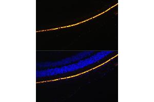 Immunofluorescence analysis of Mouse eye cells using RPE65 antibody (ABIN6130679, ABIN6147090, ABIN6147091 and ABIN6225161) at dilution of 1:100.