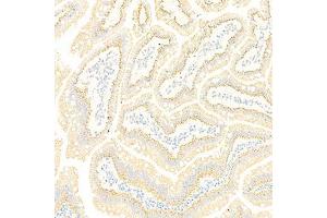 Immunohistochemistry analysis of paraffin-embedded rat small intestine using GBA (ABIN7074062) at dilution of 1: 2000 (GBA Antikörper)
